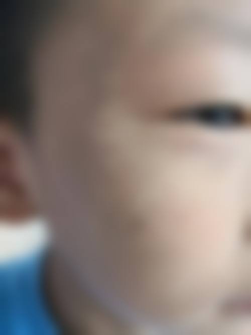 设备环境介绍:国内外精良设备与层流手术室标准