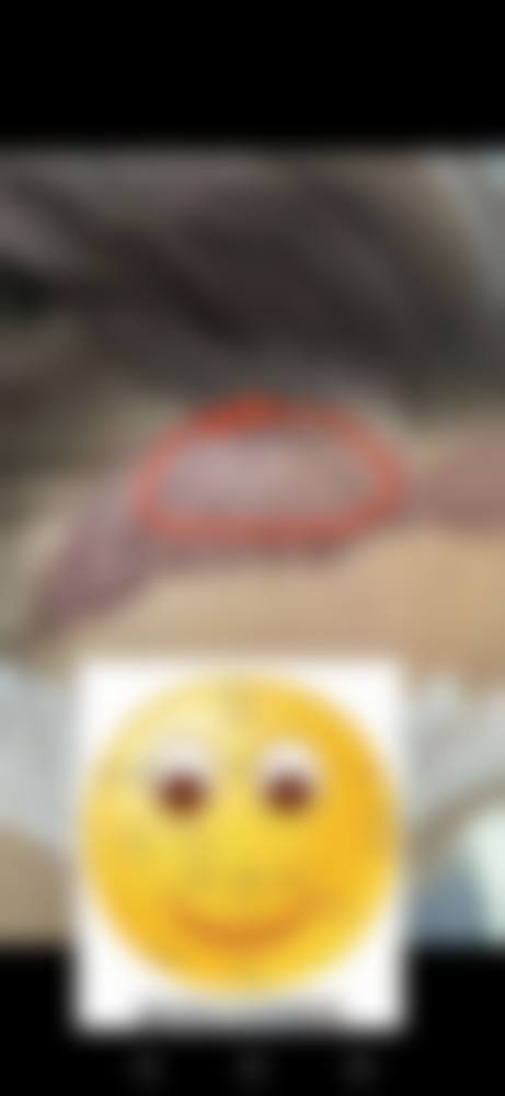 特色项目与核心技术:私密整形与激光美肤
