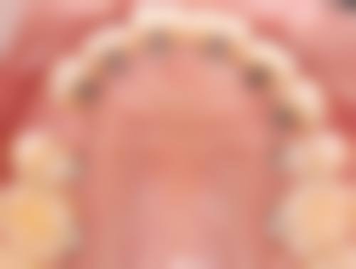 结语——立即预约，开启健康笑容
