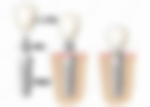 优惠活动详情