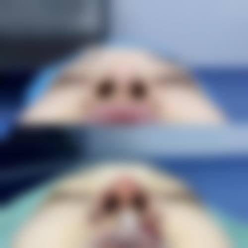临床实例分享
